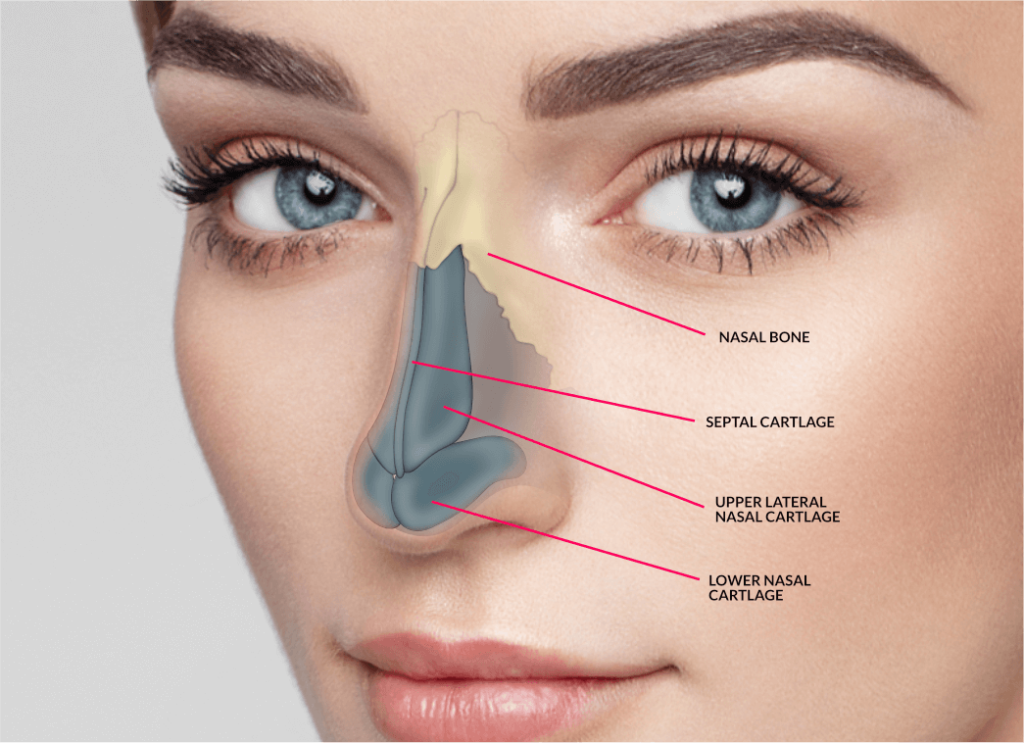 5a321a2449520e00017f7a86 Rinoplasty