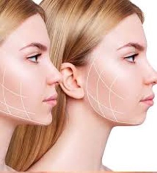 تزریق چربی برای فرم دهی نقاط مختلف صورت و بدن 1 Picture1